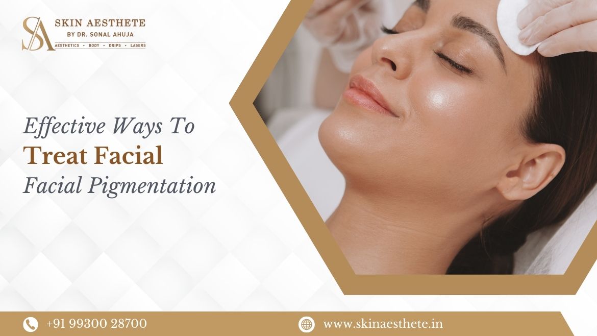 Effective Ways To Treat Facial Pigmentation