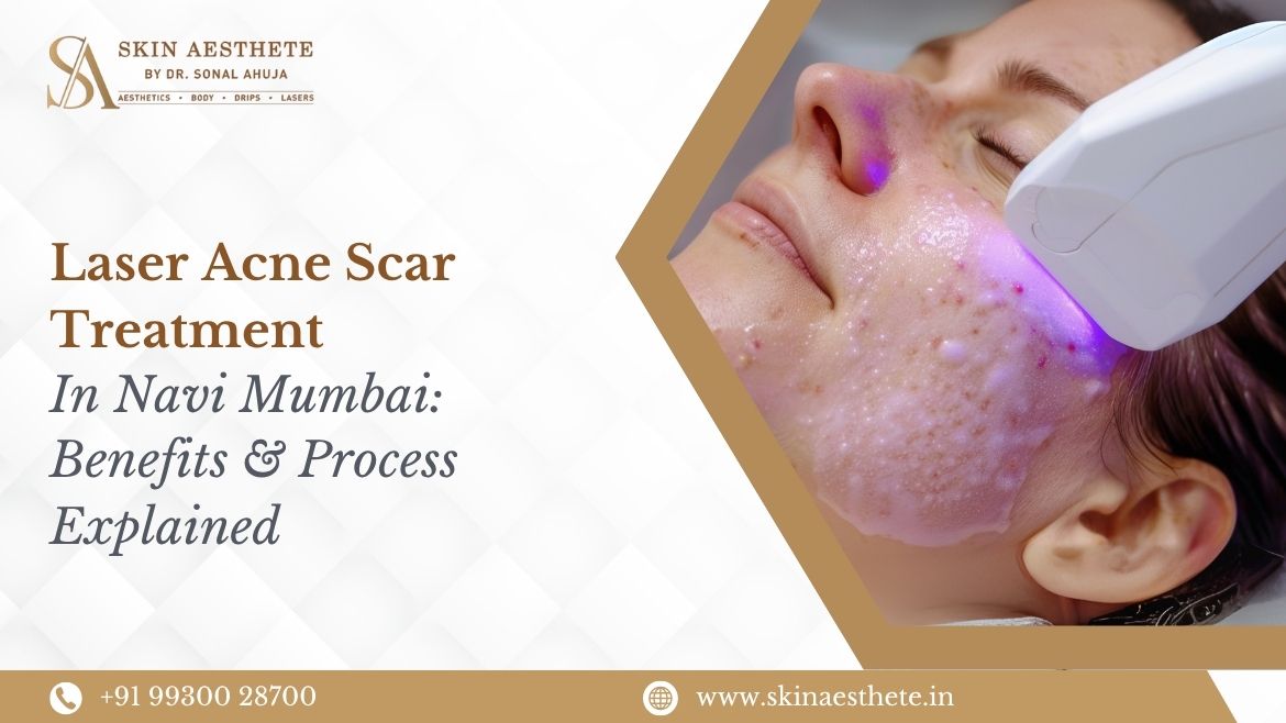 Laser Acne Scar Treatment Benefits & Process Explained 