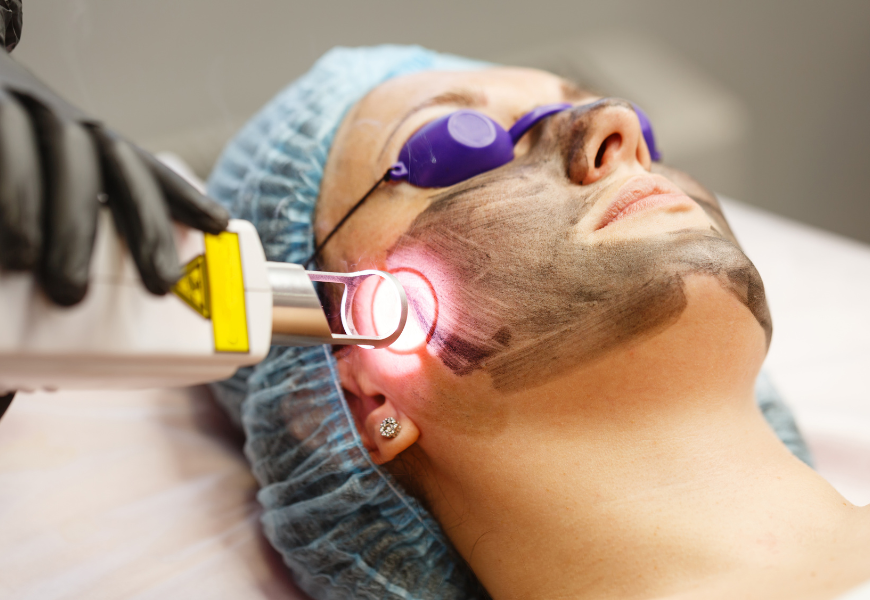 Hollywood Laser Treatment in Navi Mumbai